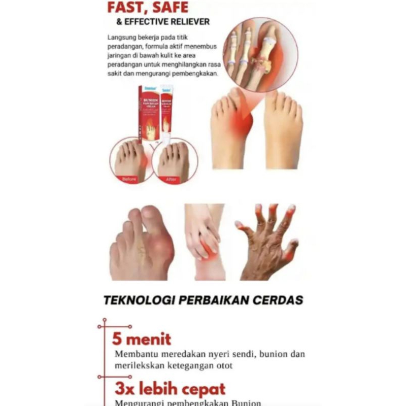 sumifun. Bunion pain Relief cream