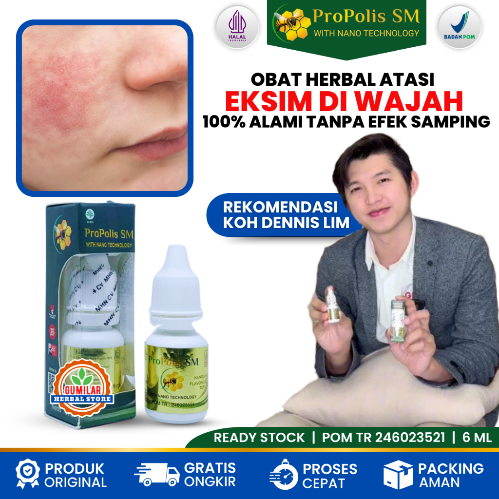 [BISA COD] Obat Gatal Eksim di Wajah Leher Telinga Pergelangan Tangan Siku Kaki Exsim Kering Menahun
