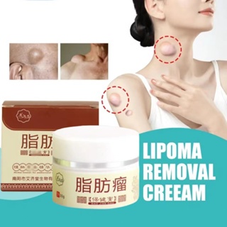 Obat Benjolan Di Leher Paling Ampuh Benjolan Di Leher salep lipoma salep benjolan Lipoma di Tangan K