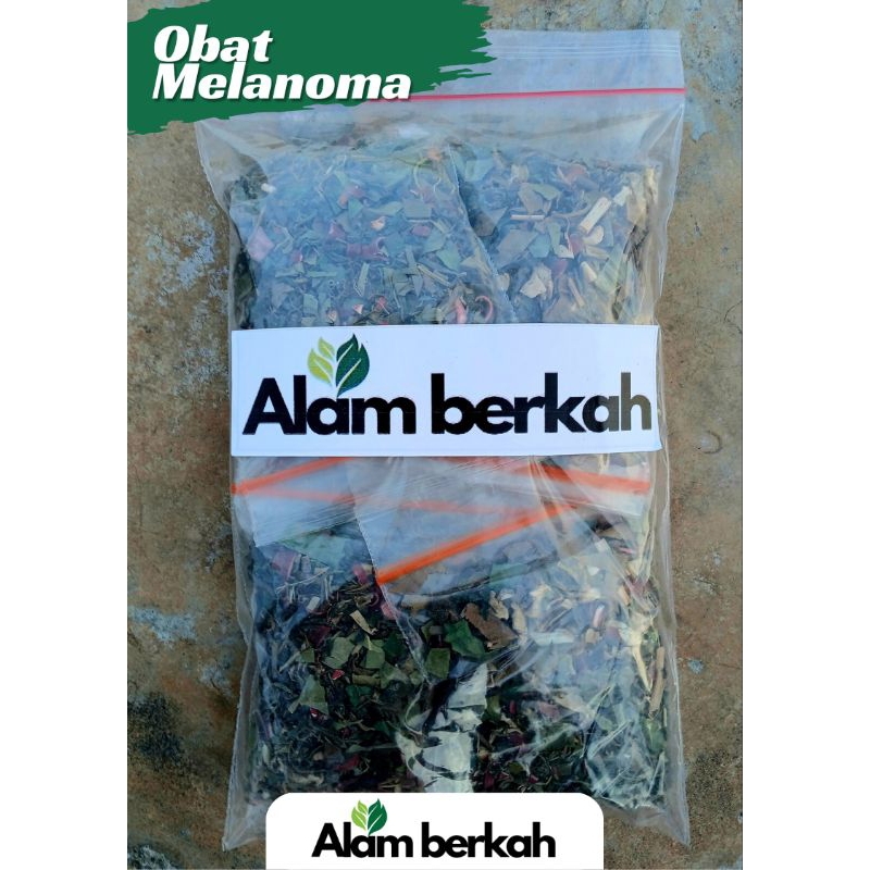 Jamu Obat Melanoma Obat Kanker Kulit