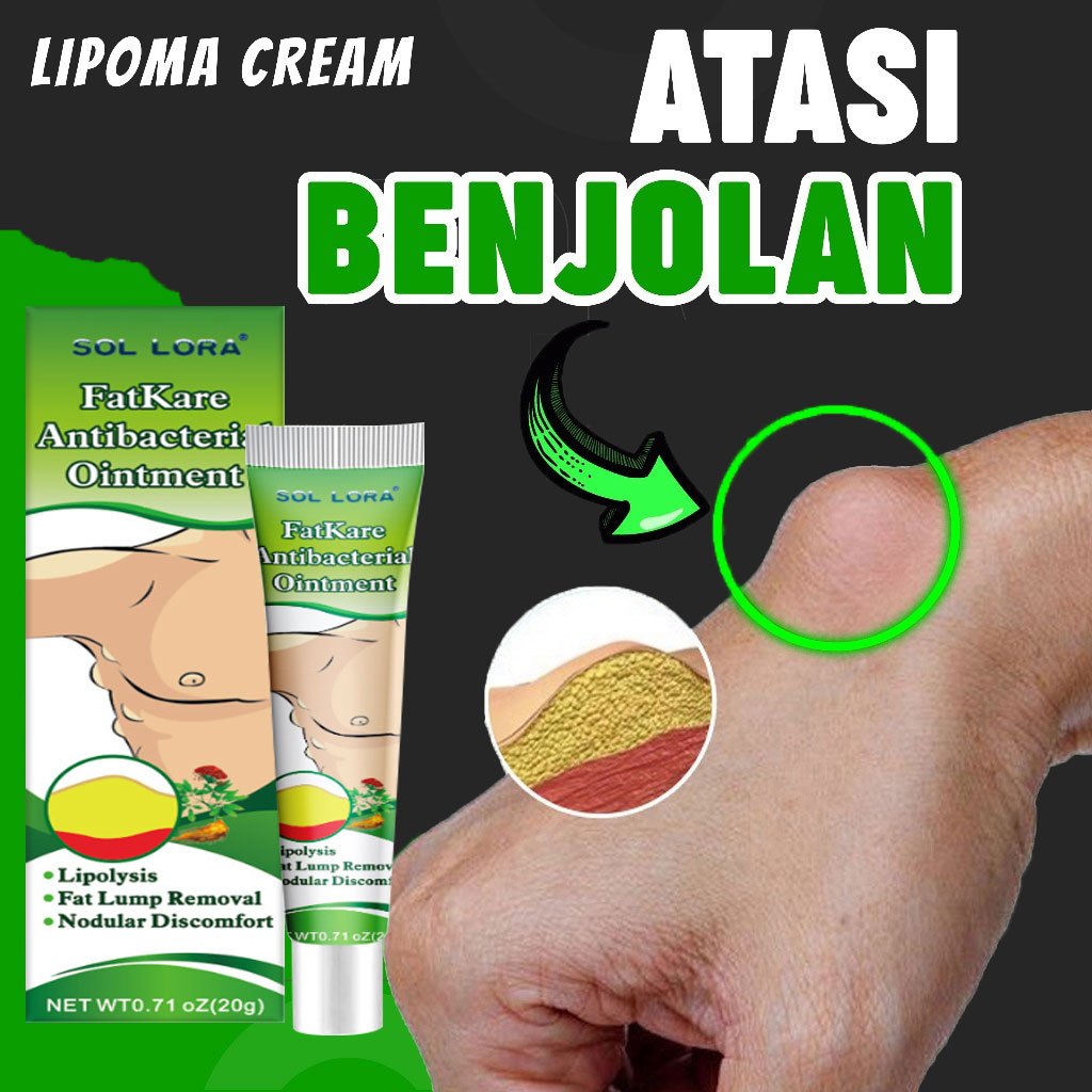 Salep Lipoma lipoma cream Meringankan Massa Subkutan Lipoma Menghilangkan Pembengkakan Lemak Mengoba