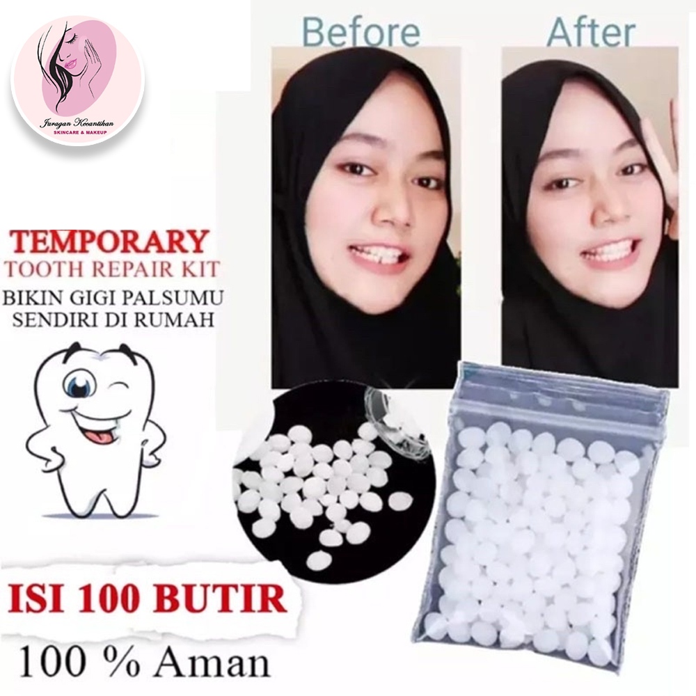 Gigi Palsu Buatan sendiri / Temptooth Penambal gigi ompong patah renggang