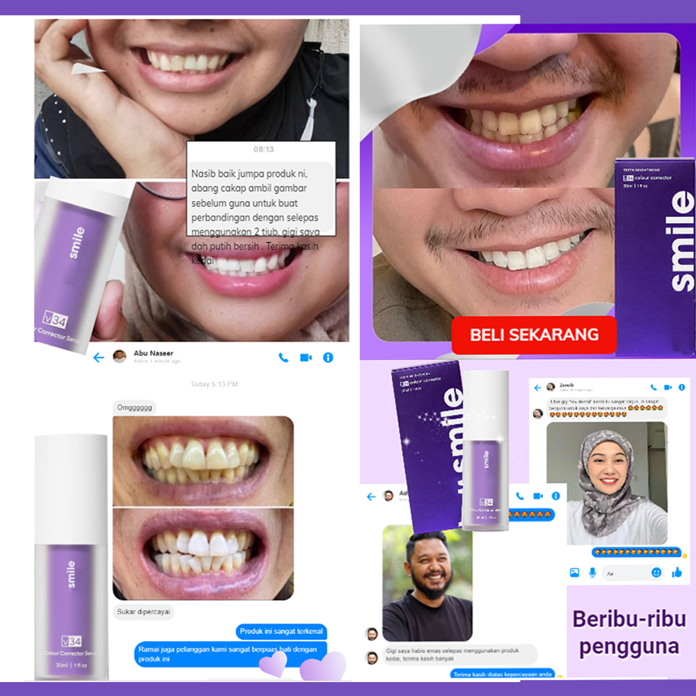 Perontok karang gigi paling ampuh Pasta gigi pemutih Perontok karang gigi 30ml Pembersih karang gigi