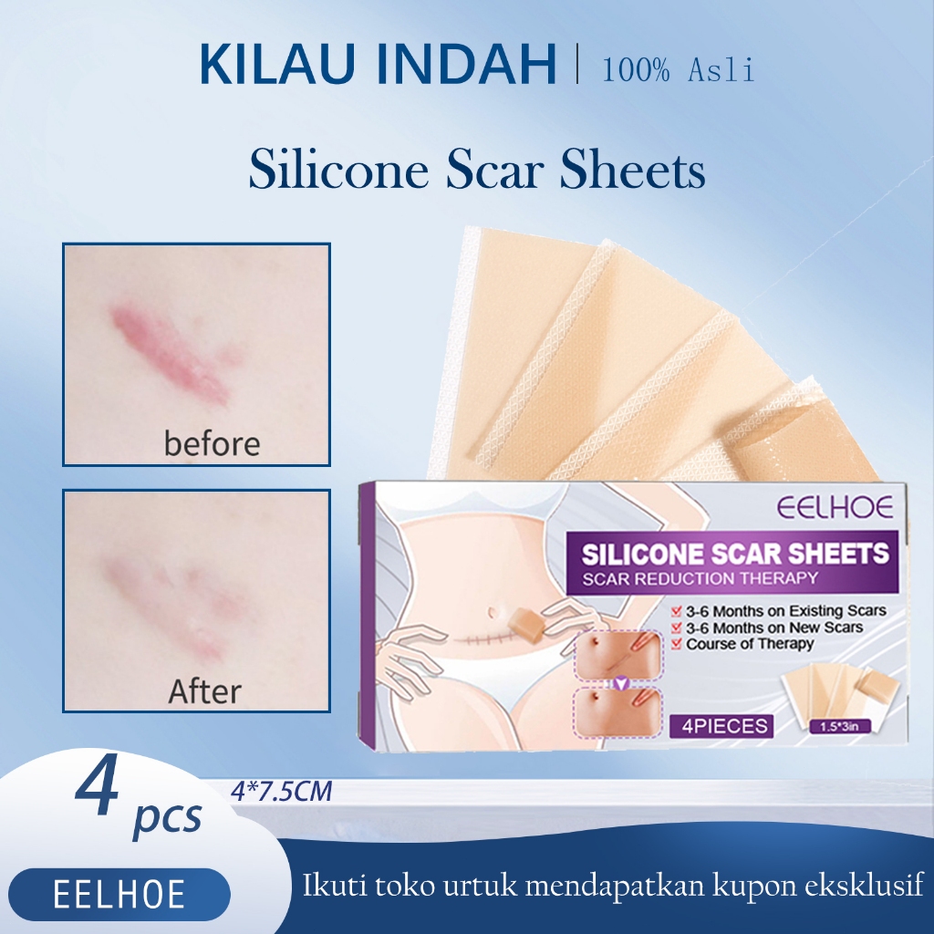 EELHOE Silicone Scar Sheets 4pcs Silicone Scar Sheet Gel /Plester Silikon /Silicone Scar Tape