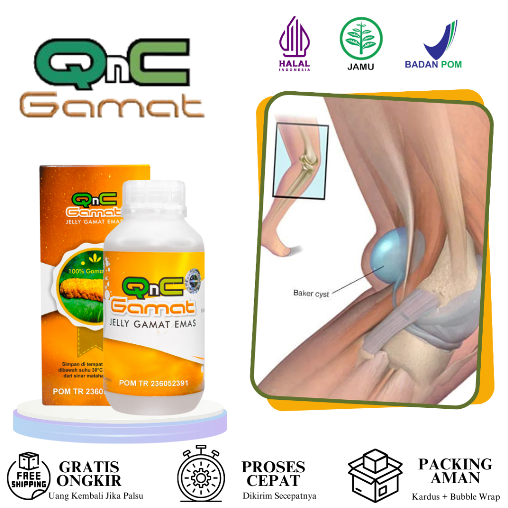 Obat Kista Baker, Benjolan Di Belakang Lutut, Kista Popliteal QnC Jelly Gamat Emas 100% Original