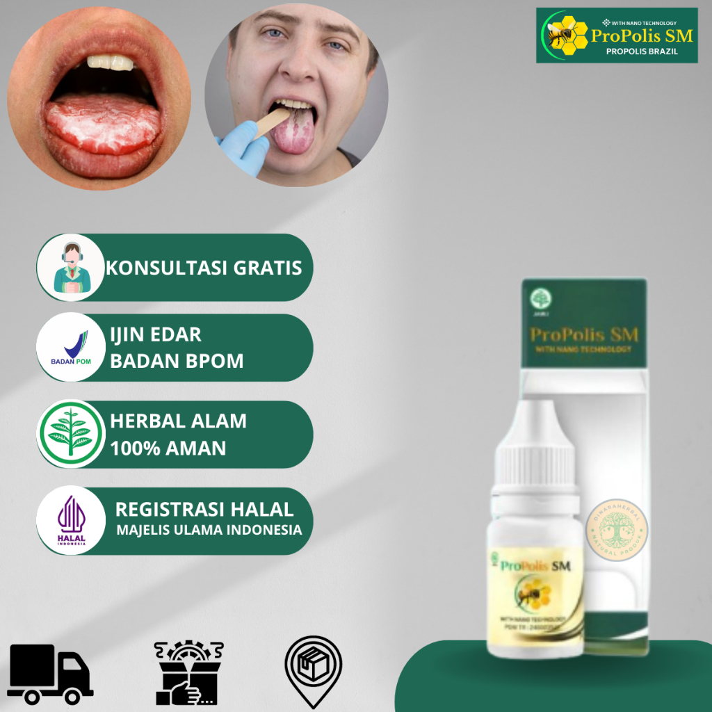 ProPolis SM Lidah Putih Terasa Pahit, Obat Lidah Mati Rasa, Lidah Kebas, Lidah Perih, Penghilang Ber
