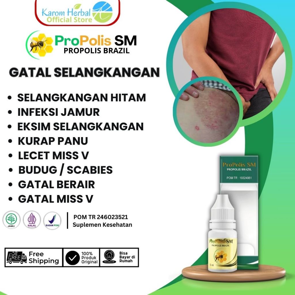 Obat Selangkangan Gatal dan Hitam Infeksi Jamur Kurap Selangkangan Eksim Selangkangan Gatal dan Lece