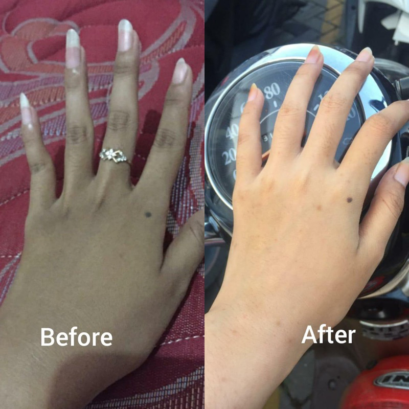 SEPAKET LOTION KURCIL BPOM AMAN BUSUI BUMIL