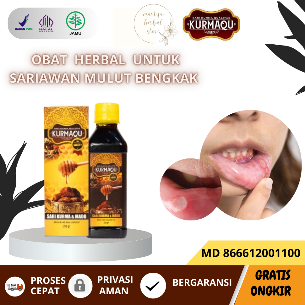 KURMAQU - Obat Herbal Sariawan Obat Sariawan Bibir Obat Sariawan Lidah Obat Sariawan Mulut Obat Sari