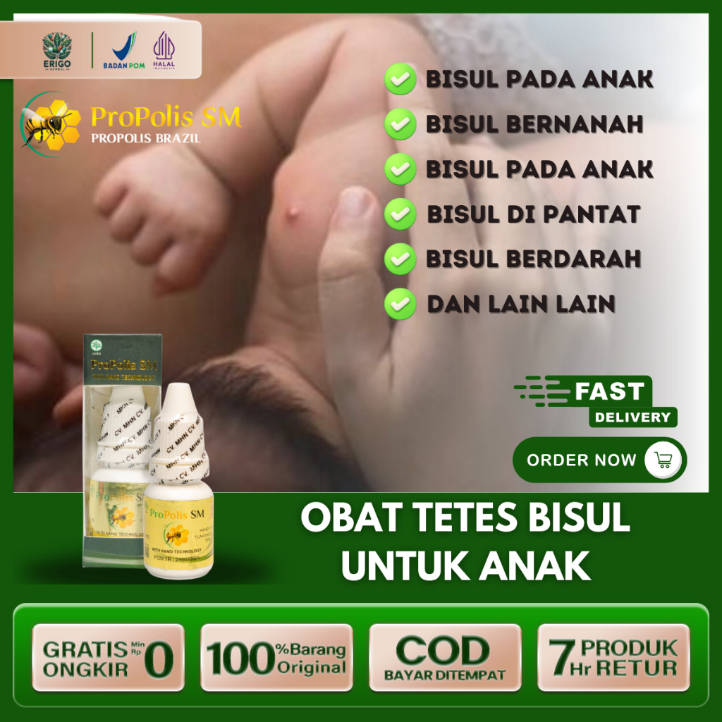 Obat Bisul Pada Bayi Bisul Bernanah Bisulan di Pantat Ketiak Kepala Untuk Anak Dan Bayi Propolis SM