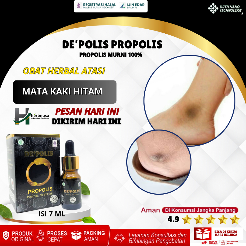 Obat Mata Kaki Hitam, Obat Kaki Kapalan, Kaki Pecah Pecah Dan Kering, Mata Kaki Bengkak Kering Hitam