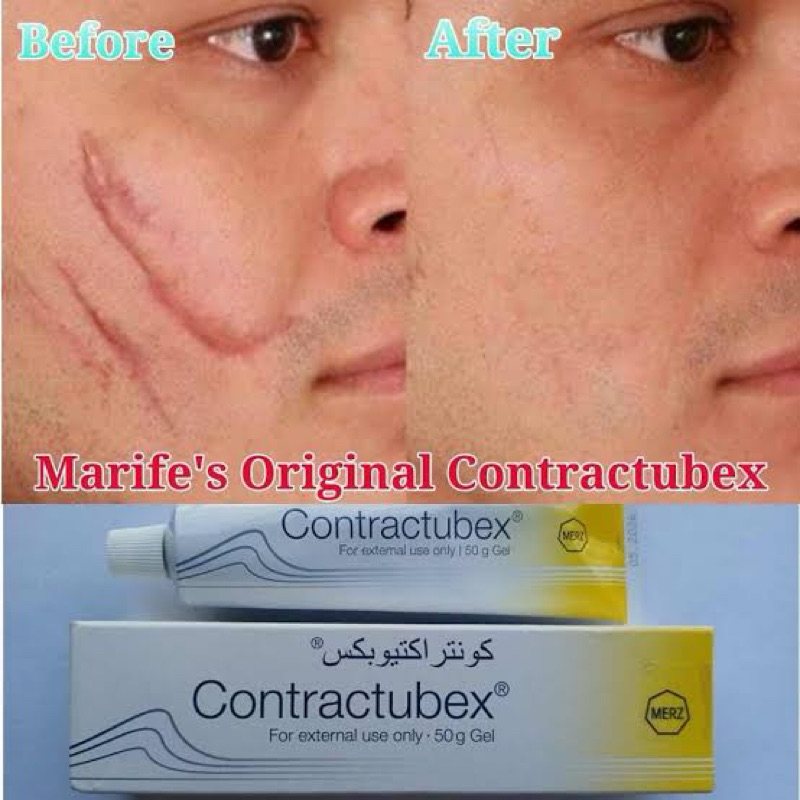 contractubex gel scar