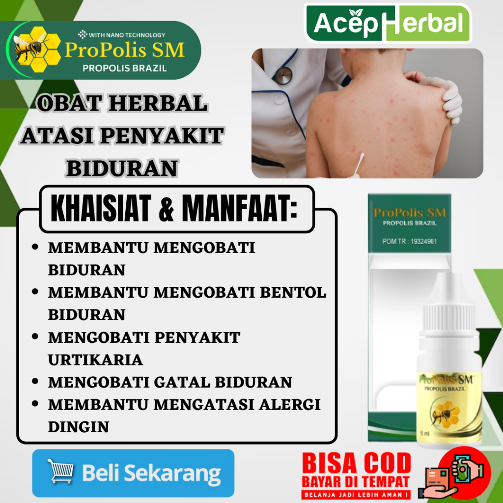 Obat Biduran - Obat Bentol Biduran, Obat Urtikaria, Obat Gatal Biduran, Obat Alergi Dingin, Obat Bid