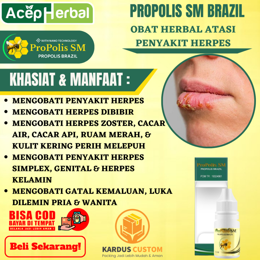 PROPOLIS SM Salep Oles Untuk Obat Herpes Atasi Obat herpes di bibir, herpes zoster, cacar air, cacar
