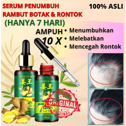 Serum Penumbuh Rambut Botak Dan Rontok Pria Anak Bayi Balita Cepat Serum Essence Penghitam Uban Peny