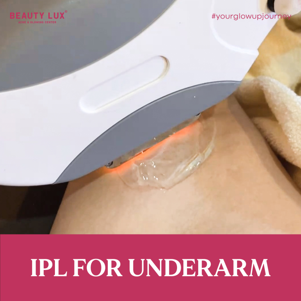 IPL UNDERARM 3X PACKAGE