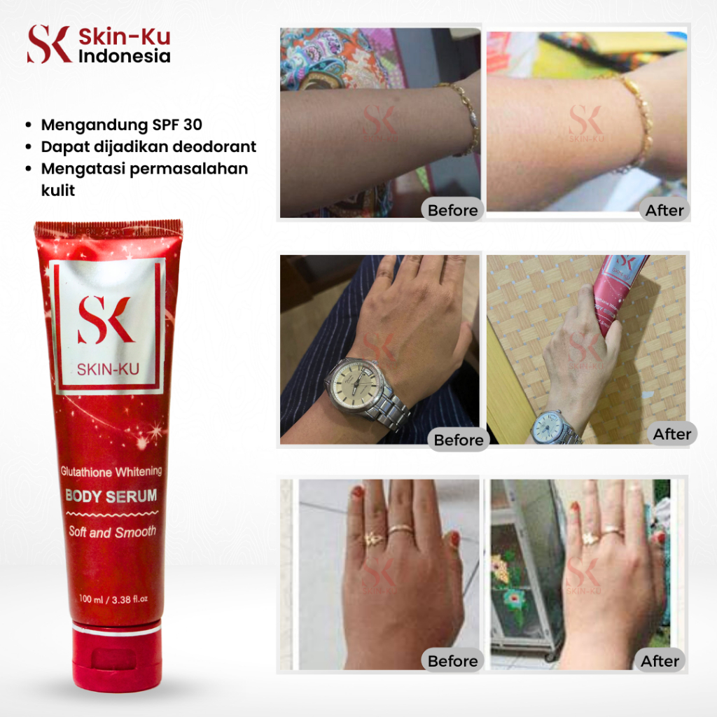 SKINKU BODY SERUM PUTIH/HILANGKAN BEKAS LUKA/DEODORANT  (BPOM) 100ml