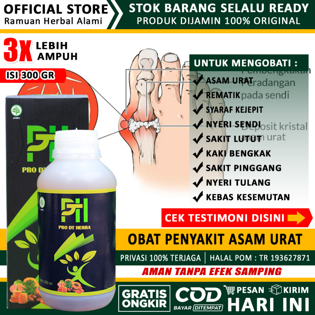 Obat asam urat | obat asam urat dan kolesterol nyeri sendi | obat asam urat paling ampuh | herbal as