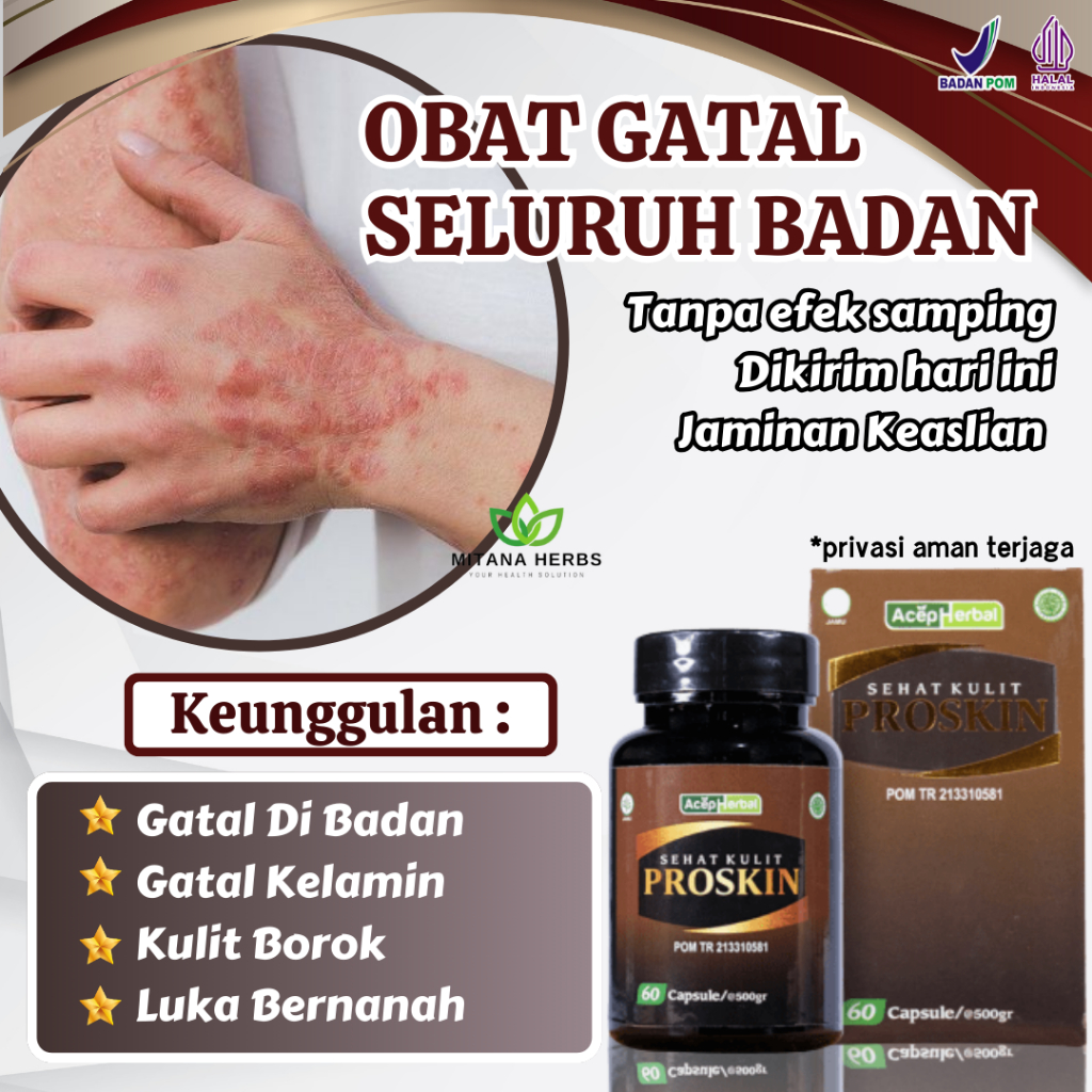 Obat Gatal Seluruh Badan - Obat Gatal Seluruh Tubuh - Obat Gatal Badan - Obat Gatal Gatal Kulit Selu
