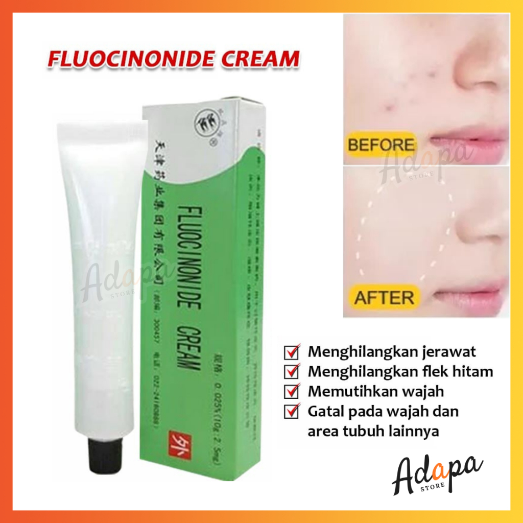 ❤ ADAPA ❤ Salep Walet Penghilang Flek Hitam / Fluocinonide Cream / Salep Gatal Kulit Paling Ampuh
