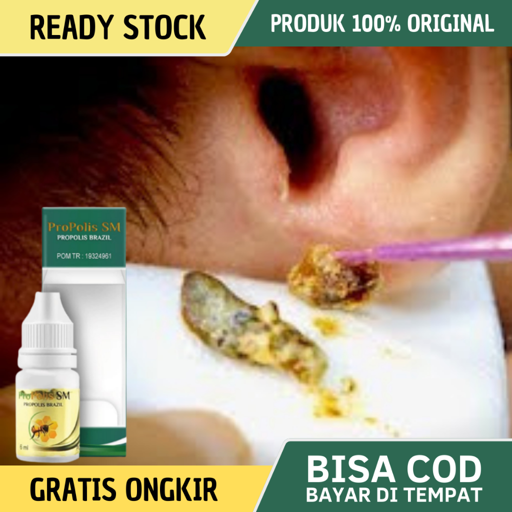 Obat Kotoran Telinga keras, Obat Telinga Tersumbat Kotoran, Obat Pencair Kotoran Telinga, Obat Pelun