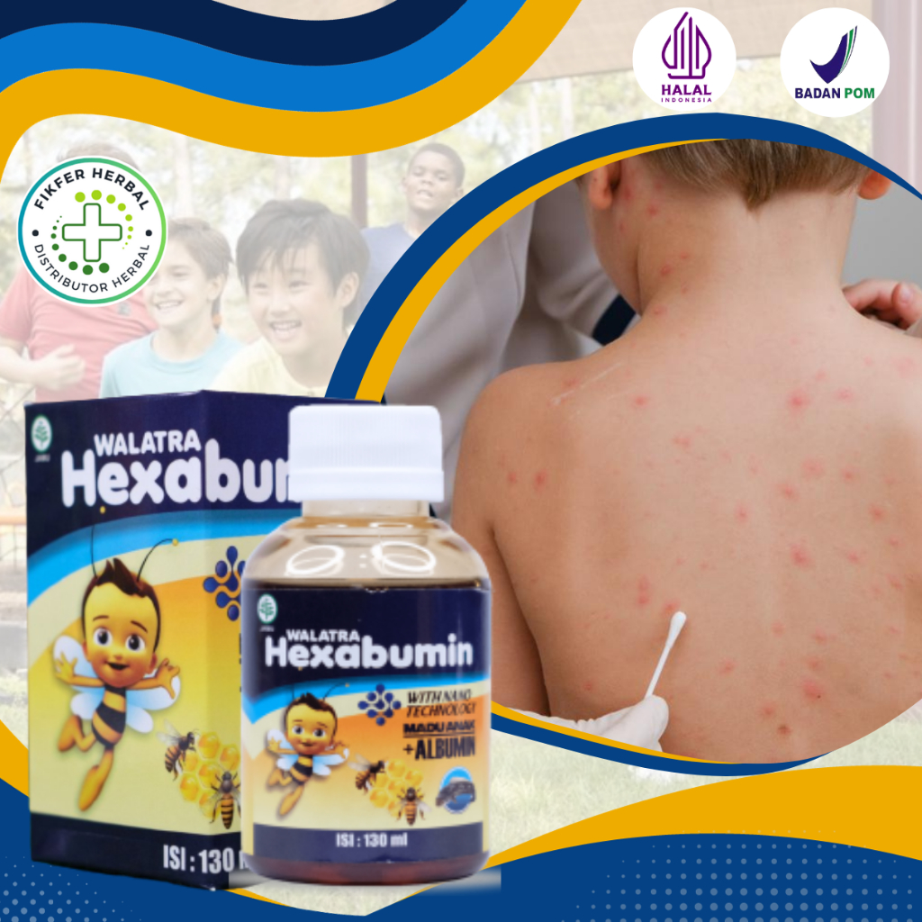 Obat Cacar Anak, Kaligata Biduran, Obat Bentol Bentol, Ruam Merah Pada Tubuh Anak, Obat Cacar Air, G
