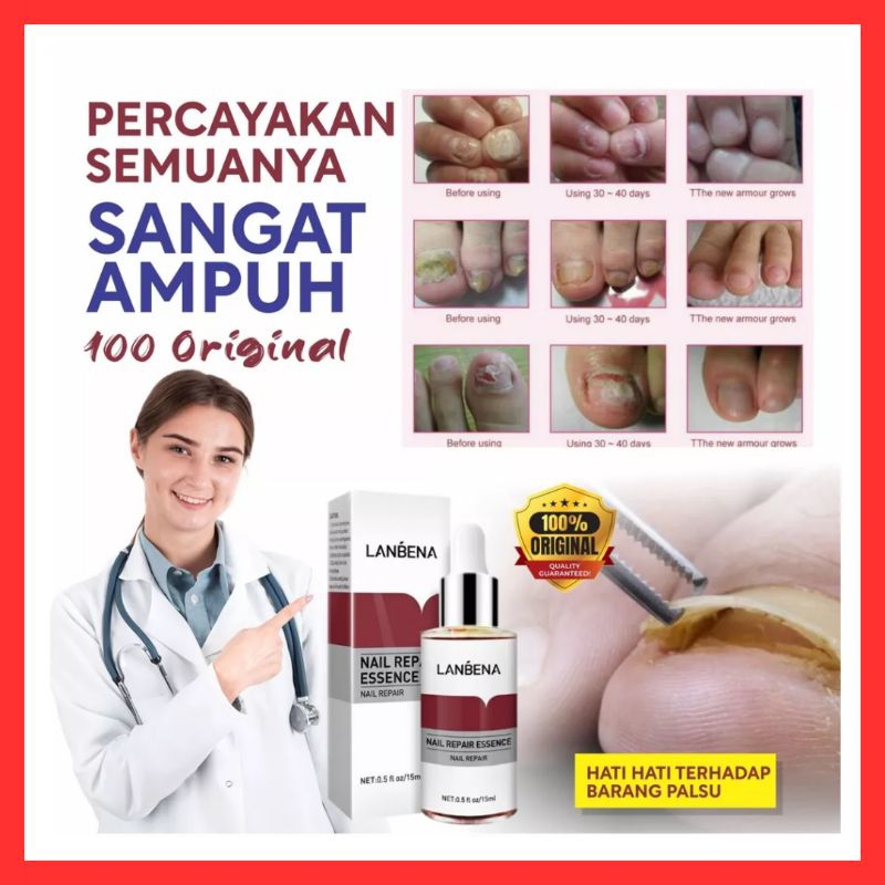 BPOM LANBENA NAIL REPAIR ESSENCE SERUM JAMUR KUKU PERAWATAN KUKU OBAT KUKU PERBAIKAN KUKU RUSAK CANT