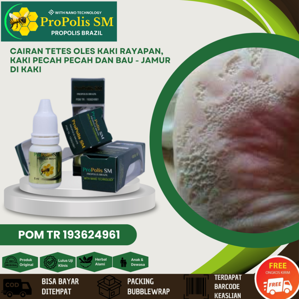 Salep Kaki Rayapan Kering Parah Gatal Dan Bau Obat Tumit Pecah Pecah Kering Cairang Penghalus Telapa
