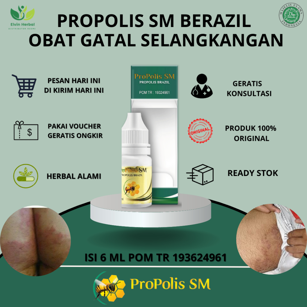 Obat Gatal Pantat Dan Selangkangan, Obat Gatal Di Pantat, Obat Penghilang Gatal Bruntus, Obat Gatal 