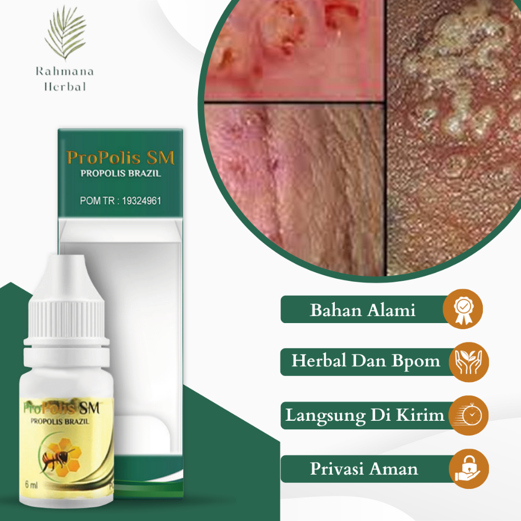 Obat Kemaluan Lecet Dan Perih, Obat Luka Kemaluan, Obat Salep Luka Kelamin, Obat Oles Gatal Kemaluan
