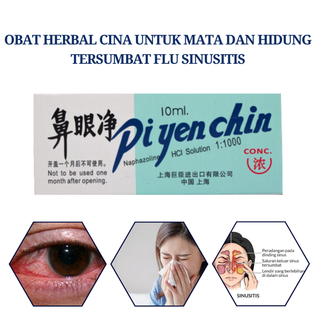 Obat Sinusitis Flu Hidung Buntu Tersumbat Bersin Terus Menerus Herbal Cina Tetes Mata Gatal Merah He