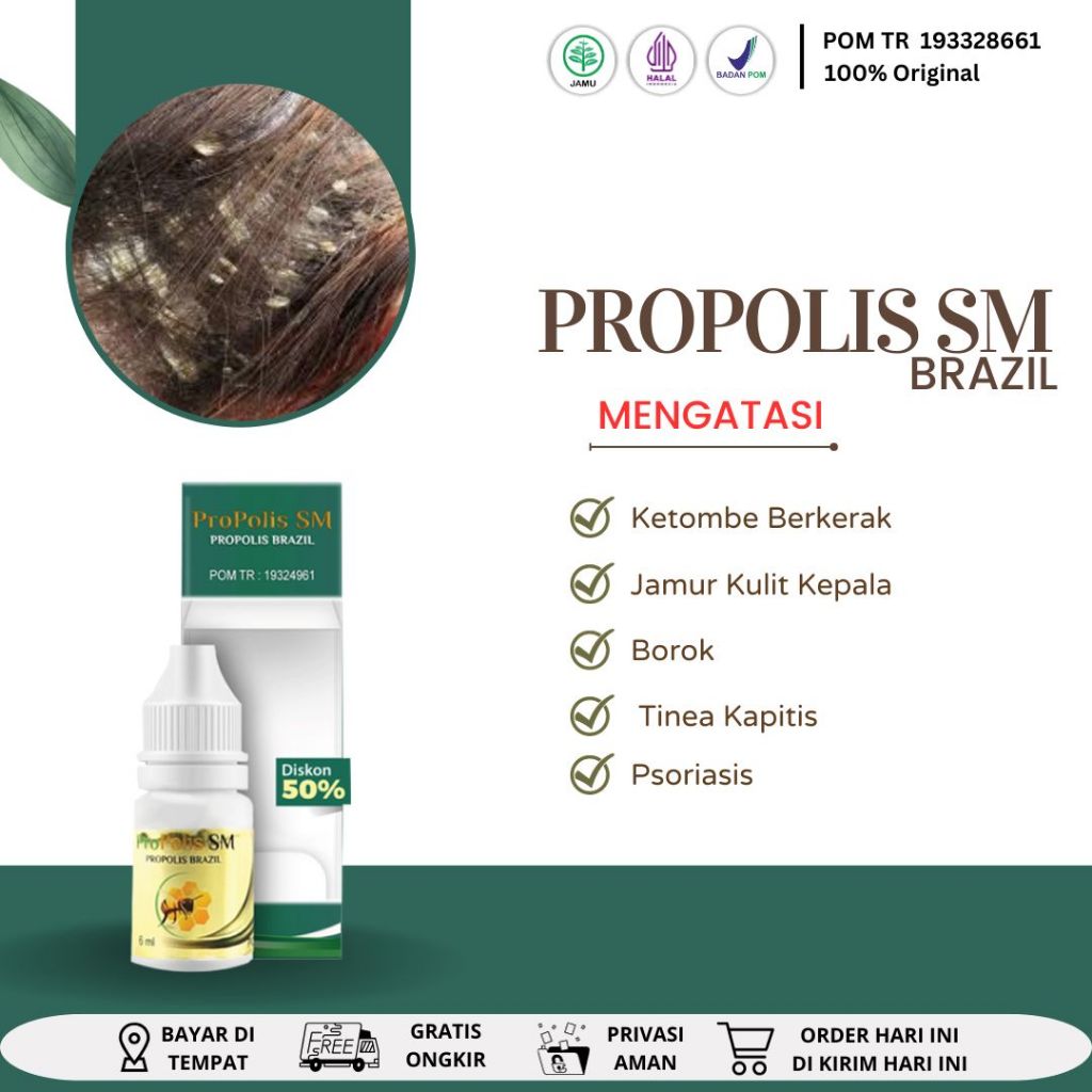 Obat Ketombe Kerak Kulit Kepala, Obat jamur kulit di Kepala Berkerak anak dan Dewasa, Tinea Kapitis,