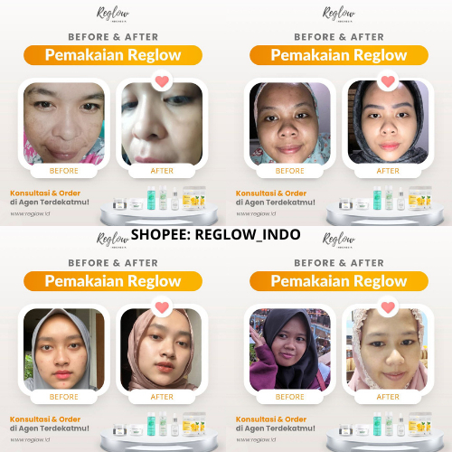 Reglow Intensive Whitening Night Cream Atasi Flek Membandel Mencerahkan & Memperbaiki Tekstur Kulit