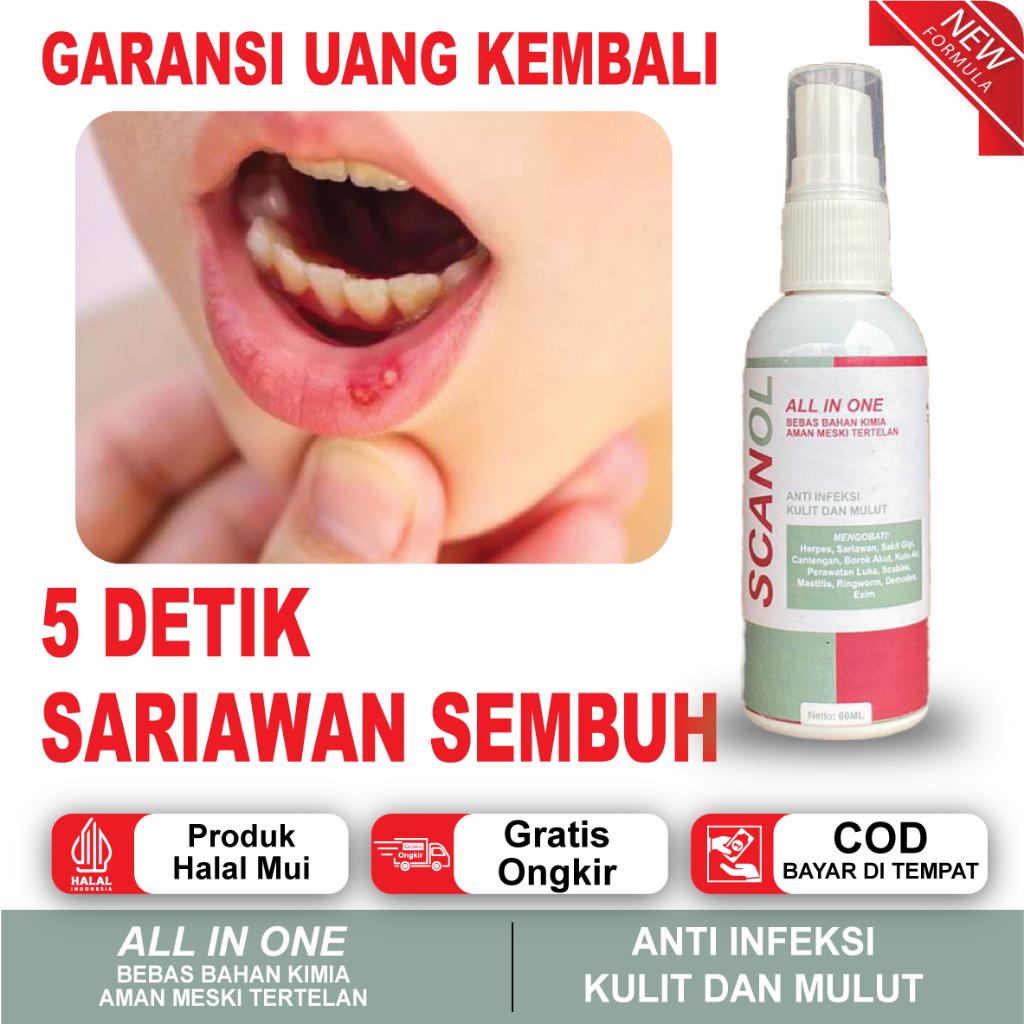 Obat Spray Sariawan Mulut, Sariawan Lidah, Sariawan Bibir, Sariawan Tenggorokan, Herpes Bibir Aman M