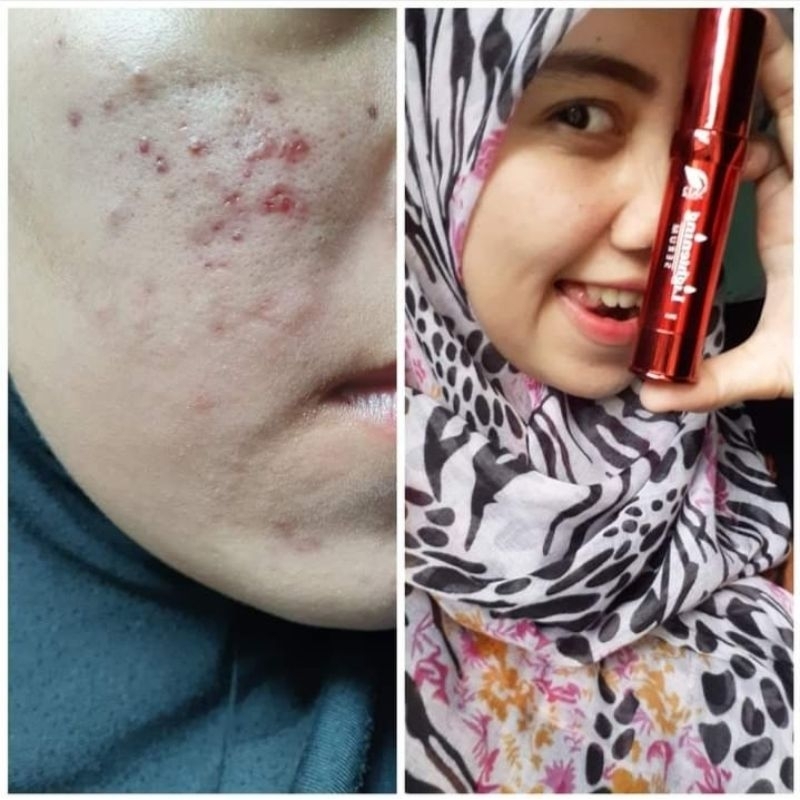 SERUM WAJAH GLOWING DAN PUTIH /LIGHTENING SERUM SR12 /Serum wajah berminyak,berjerawat,kusam