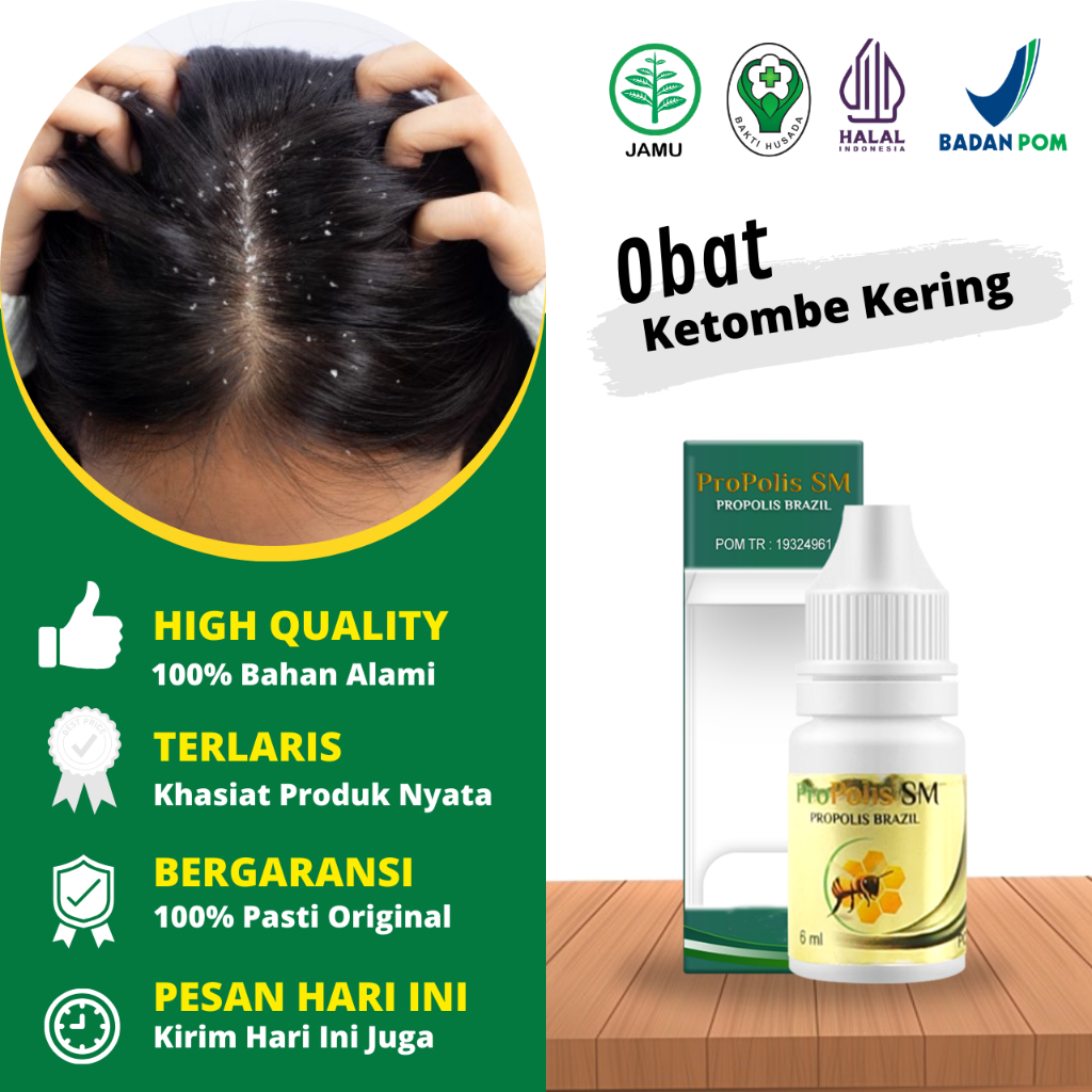 Obat Ketombe Kering, Ketombe Berkerak - Ketombe Akut - Ketombe Parah Rambut Rontok, Obat Tetes Ketom