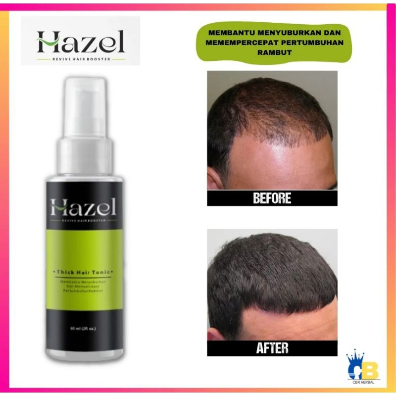 Hazel Hair Tonic Penumbuh Rambut Kebotakan Ampuh Dan Cepat 60ml