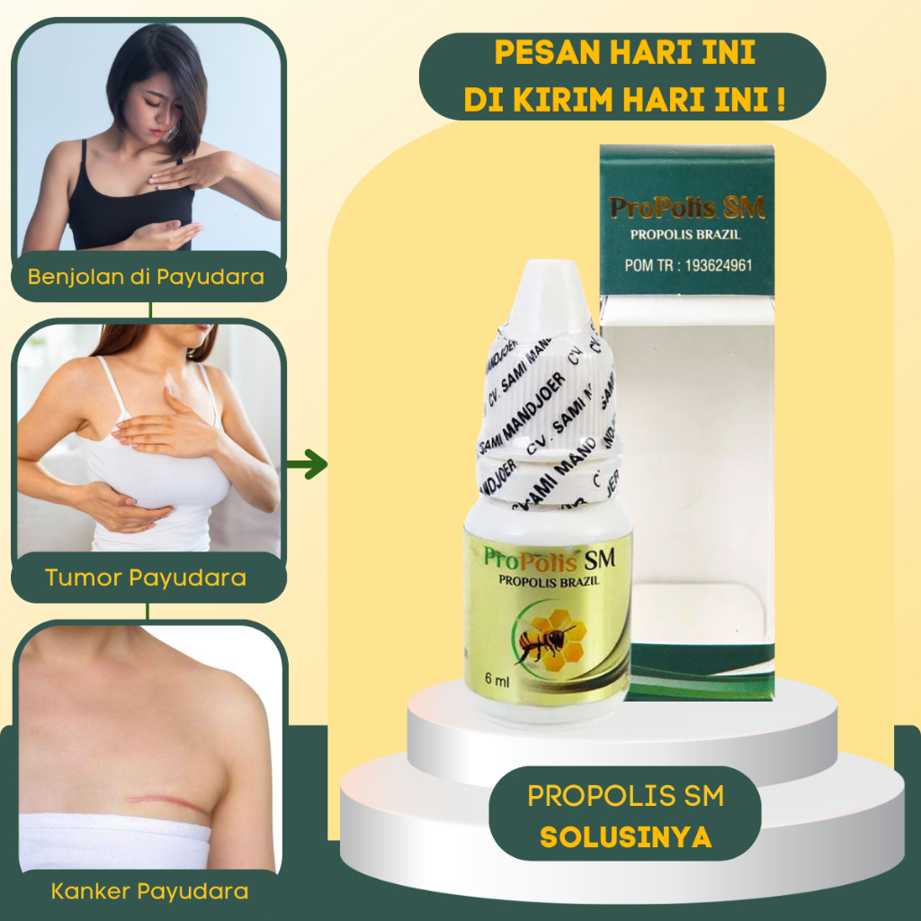 Obat Tumor Kista Kanker Payudara - Obat Benjolan Di Payudara Penghancur Benjolan Kista Payudara Nyer
