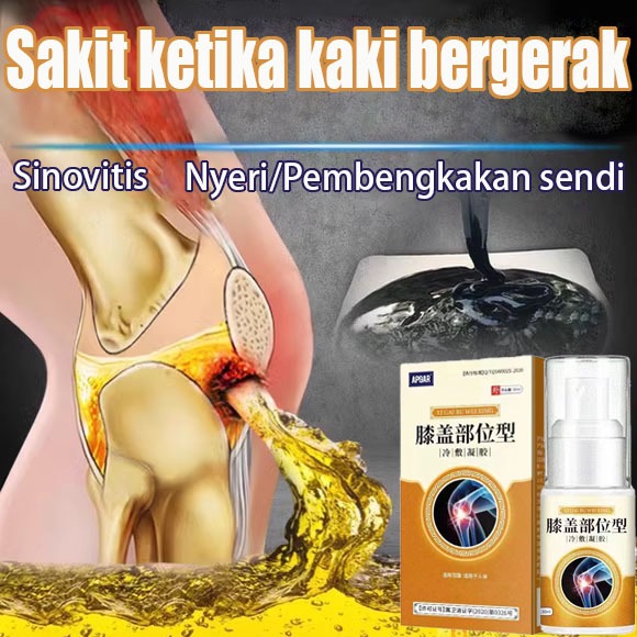 Obat Nyeri Sendi Spray Arthritis Lutut Nyeri Gout 30ml Nyeri Sendi Lutut Herbal Ampuh Nyeri sendi lu