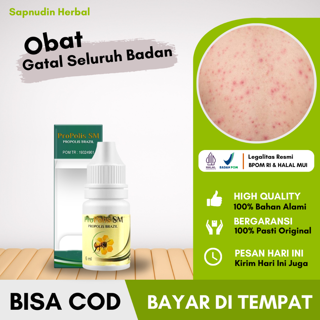 Obat Gatal Seluruh Badan, Obat Gatal Berair, Obat Gatal Menahun, Obat Gatal Alergi, Obat Gatal Gatel