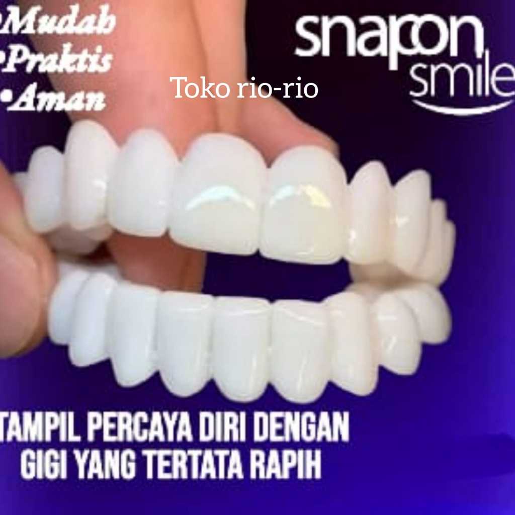 Snap On Smile Venner Gigi Palsu 1 SET (ATAS &amp; BAWAH) Gigi Palsu Silikon ORIGINAL/CUCI GUDANG