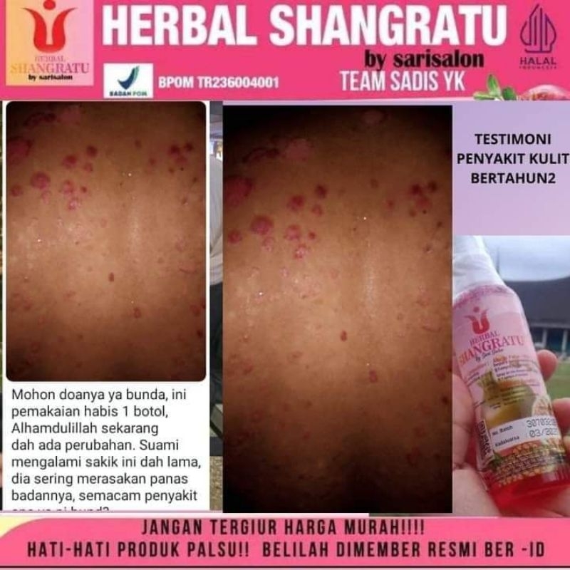 

COD(HERBALSHANGRATU)