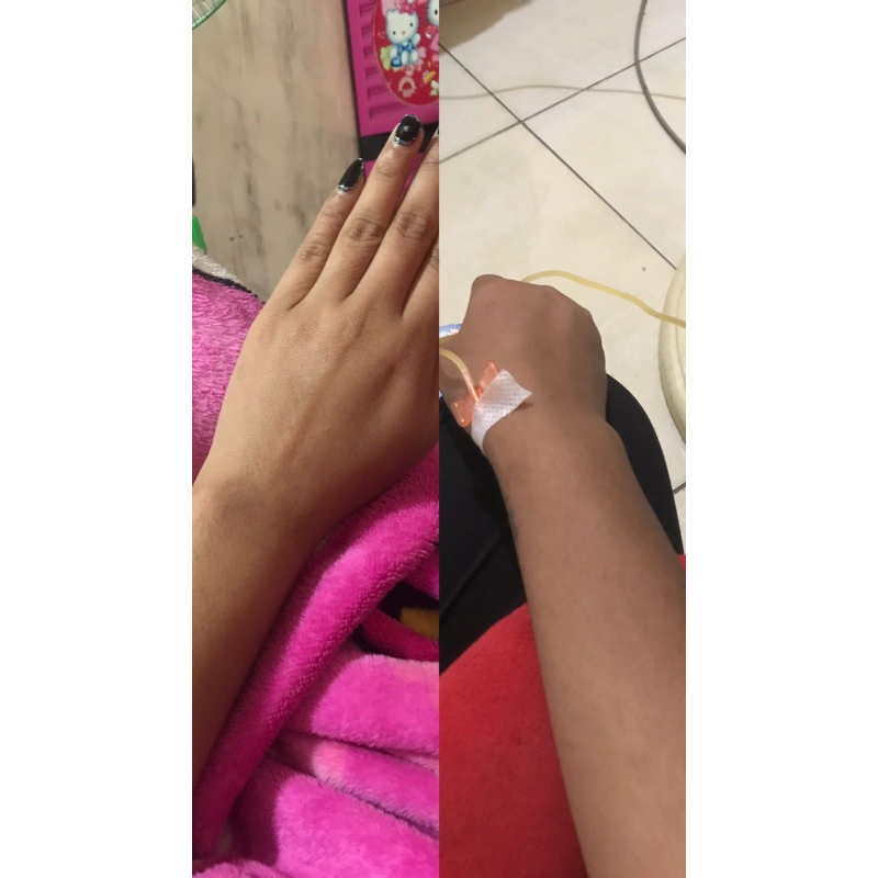infus whitening booster