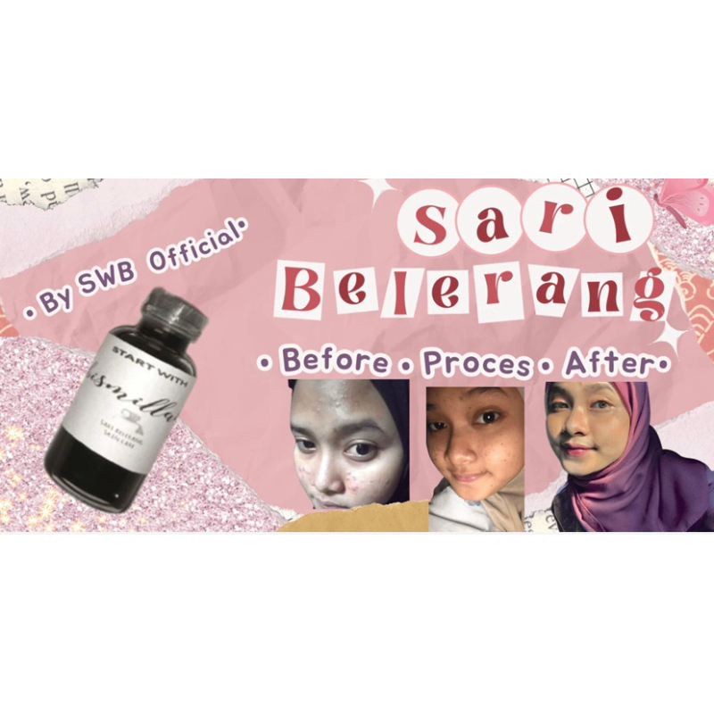 Sari Belerang 60 ML FREE COTTON BUD|| Penghilang Jerawat, Panu, Kudis