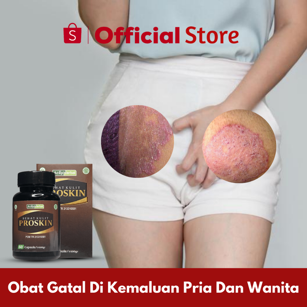 Obat Gatal Di Kemaluan Pria Dan Wanita, Gatal Selangkangan, Gatal Buah Zakar, Selangkangan Hitam, Ba