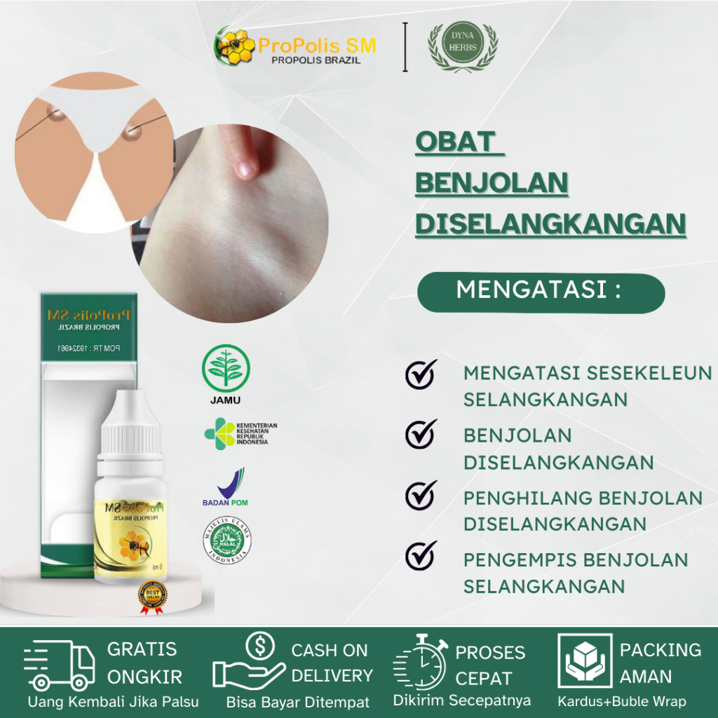 Obat Benjolan Selangkangan, Obat Penghancur Benjolan di Selangkangan, Obat Benjolan Pada Selangkanga