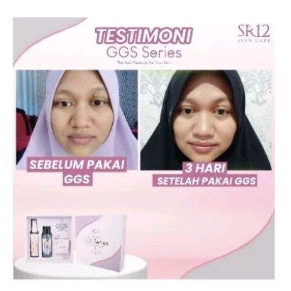 Ggs series sr12