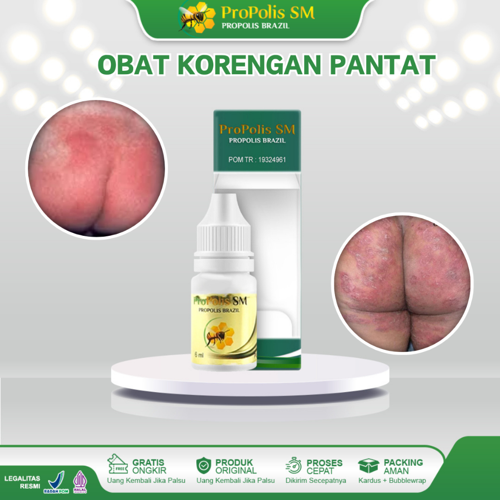 Obat Korengan Di Pantat Gatal Gatal Beruntus Di Pantat Jerawatan Pantat Bintik Bintik Merah Pantat B