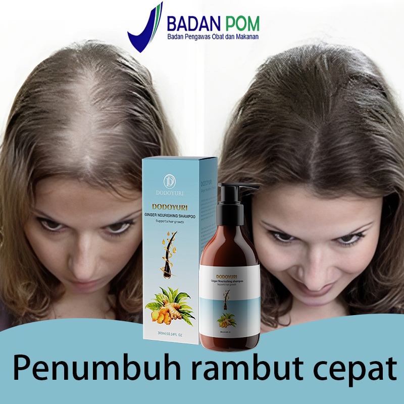 [BPOM] Sampo penumbuh rambut cepat sampo rambut rontok shampo pemanjang rambut cepat 300ml Shampo Ja