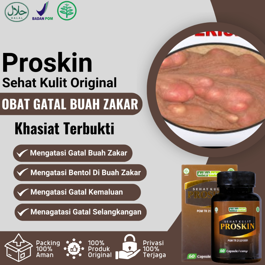 Obat Gatal Buah Zakar - Obat Gatal Bentol Kemaluan Pria - Obat Bentol Di Buah Zakar - Obat Gatal Bua